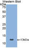 Cystatin B antibody, LS-C293620, Lifespan Biosciences, Western Blot image 