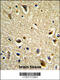 Cytochrome P450 Family 2 Subfamily E Member 1 antibody, 63-565, ProSci, Immunohistochemistry paraffin image 