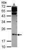 Claudin 4 antibody, PA5-28830, Invitrogen Antibodies, Western Blot image 