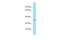 ADP Ribosylation Factor Like GTPase 6 Interacting Protein 4 antibody, A11866, Boster Biological Technology, Western Blot image 