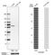 Unc-93 Homolog B1, TLR Signaling Regulator antibody, HPA038716, Atlas Antibodies, Western Blot image 