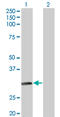 N-Acetyltransferase 2 antibody, LS-C196589, Lifespan Biosciences, Western Blot image 