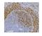 CD79b Molecule antibody, M01399-1, Boster Biological Technology, Immunohistochemistry paraffin image 