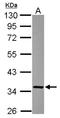 Fructosamine 3 Kinase Related Protein antibody, NBP2-16536, Novus Biologicals, Western Blot image 