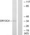 Olfactory Receptor Family 13 Subfamily C Member 4 antibody, TA316117, Origene, Western Blot image 