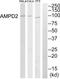 AMP deaminase 2 antibody, abx014178, Abbexa, Western Blot image 