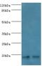 Nuclear Cap Binding Protein Subunit 2 antibody, LS-C376198, Lifespan Biosciences, Western Blot image 