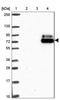 Lysine Methyltransferase 2E antibody, NBP2-33775, Novus Biologicals, Western Blot image 