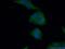 Glycogen Phosphorylase, Muscle Associated antibody, 19716-1-AP, Proteintech Group, Immunofluorescence image 