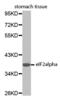 Eukaryotic Translation Initiation Factor 2 Subunit Alpha antibody, abx000851, Abbexa, Western Blot image 