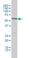 Solute Carrier Family 18 Member A1 antibody, H00006570-M01, Novus Biologicals, Western Blot image 