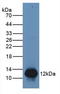 S100 Calcium Binding Protein A8 antibody, LS-C314258, Lifespan Biosciences, Western Blot image 