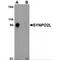 Synaptopodin 2 Like antibody, MBS151544, MyBioSource, Western Blot image 