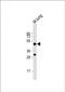 Dipeptidase 2 antibody, PA5-72282, Invitrogen Antibodies, Western Blot image 