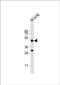 Dipeptidase 2 antibody, PA5-72282, Invitrogen Antibodies, Western Blot image 