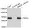 Transforming Growth Factor Beta Regulator 4 antibody, LS-C330889, Lifespan Biosciences, Immunoprecipitation image 