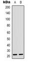 CD300 Molecule Like Family Member D antibody, LS-C368730, Lifespan Biosciences, Western Blot image 