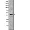 Proteasome Subunit Alpha 7 antibody, abx218036, Abbexa, Western Blot image 