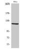 Ro antibody, A02144-1, Boster Biological Technology, Western Blot image 