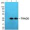 TNFRSF1A Associated Via Death Domain antibody, A02785, Boster Biological Technology, Western Blot image 