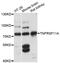 TNF Receptor Superfamily Member 11a antibody, LS-C748060, Lifespan Biosciences, Western Blot image 