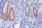 Desmoglein 2 antibody, A02035, Boster Biological Technology, Immunohistochemistry frozen image 