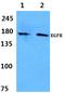 EGFR antibody, A00023S1104, Boster Biological Technology, Western Blot image 