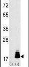 Eukaryotic Translation Initiation Factor 4E Binding Protein 1 antibody, PA5-11830, Invitrogen Antibodies, Western Blot image 