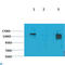 Solute Carrier Family 12 Member 4 antibody, LS-C813644, Lifespan Biosciences, Western Blot image 