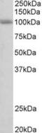 SID1 Transmembrane Family Member 1 antibody, NBP2-27547, Novus Biologicals, Western Blot image 