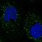 Speckle Type BTB/POZ Protein Like antibody, HPA034687, Atlas Antibodies, Immunofluorescence image 