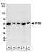 Splicing Factor 3b Subunit 4 antibody, A303-950A, Bethyl Labs, Western Blot image 