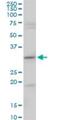 Centromere Protein H antibody, H00064946-B02P, Novus Biologicals, Western Blot image 