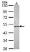 Corticotropin Releasing Hormone Receptor 2 antibody, PA5-28755, Invitrogen Antibodies, Western Blot image 