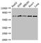 Eukaryotic Translation Initiation Factor 2 Alpha Kinase 1 antibody, LS-C677787, Lifespan Biosciences, Western Blot image 