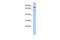 Oxidative Stress Induced Growth Inhibitor 1 antibody, GTX45178, GeneTex, Western Blot image 