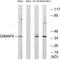 GTPase, IMAP Family Member 4 antibody, A10738, Boster Biological Technology, Western Blot image 