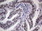 Tousled Like Kinase 2 antibody, LS-C799805, Lifespan Biosciences, Immunohistochemistry paraffin image 