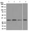 Cyclin Dependent Kinase 4 antibody, ab108357, Abcam, Western Blot image 