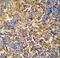 Inhibitor Of Bruton Tyrosine Kinase antibody, LS-C165102, Lifespan Biosciences, Immunohistochemistry frozen image 