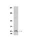 Ras Homolog Family Member A antibody, NBP2-29740, Novus Biologicals, Western Blot image 