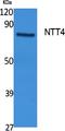 Solute Carrier Family 6 Member 17 antibody, A12725, Boster Biological Technology, Western Blot image 