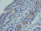 Polypeptide N-Acetylgalactosaminyltransferase 10 antibody, orb75245, Biorbyt, Immunohistochemistry paraffin image 