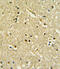 Paired Box 6 antibody, A00273-1, Boster Biological Technology, Immunohistochemistry paraffin image 