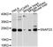 Synaptosome Associated Protein 23 antibody, A13909, ABclonal Technology, Western Blot image 