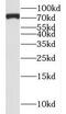 LZTS2 antibody, FNab04918, FineTest, Western Blot image 