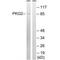 Protein Kinase CGMP-Dependent 2 antibody, MBS9408757, MyBioSource, Western Blot image 