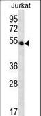DDB1 And CUL4 Associated Factor 12 antibody, LS-C160583, Lifespan Biosciences, Western Blot image 