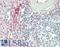 Endoglin antibody, LS-B14081, Lifespan Biosciences, Immunohistochemistry paraffin image 