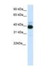 Tetratricopeptide Repeat Domain 19 antibody, NBP1-91552, Novus Biologicals, Western Blot image 